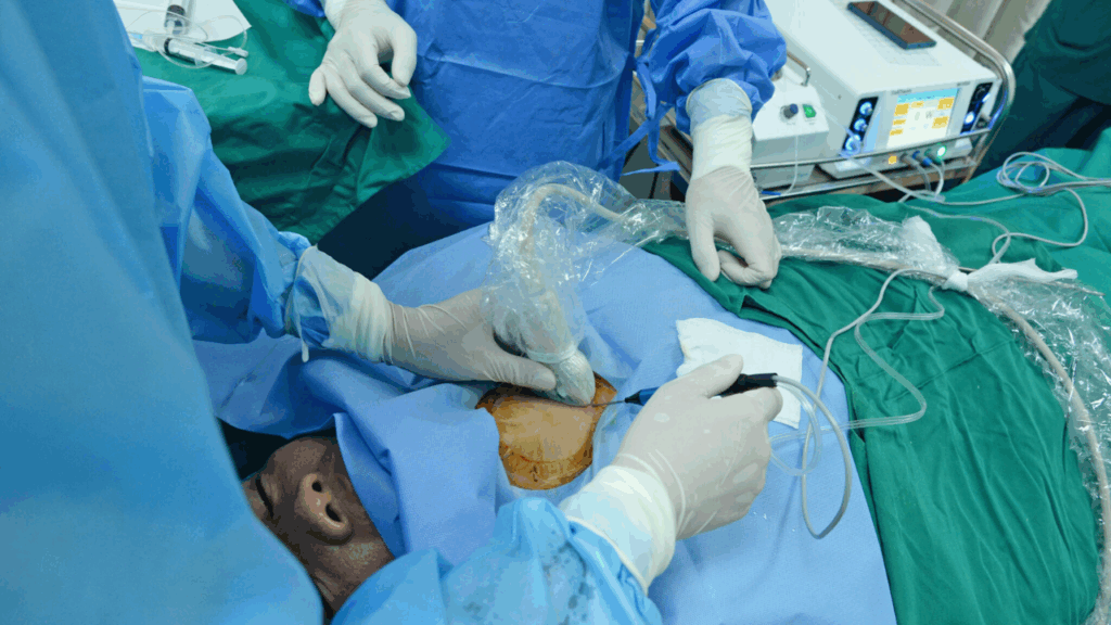 Ung thư tuyến giáp thể nhú có thể điều trị bằng phương pháp đốt sóng cao tần RFA